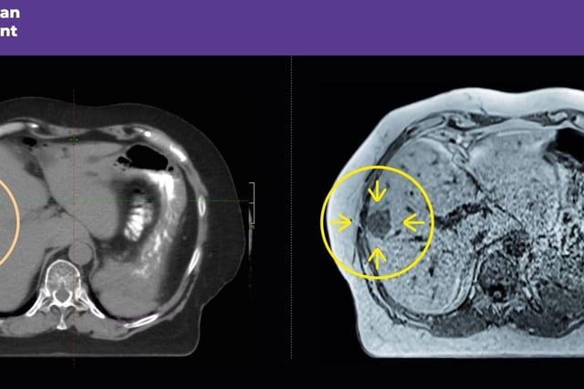 CT scan vs MRI Simulator scan image