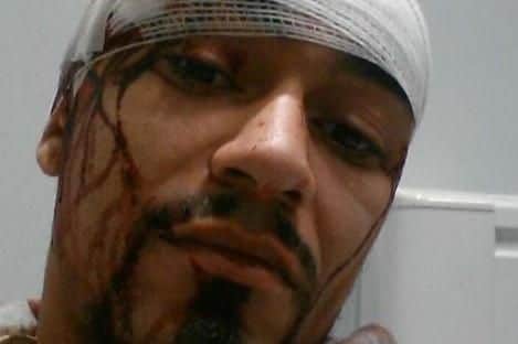Christopher Williams after the attack