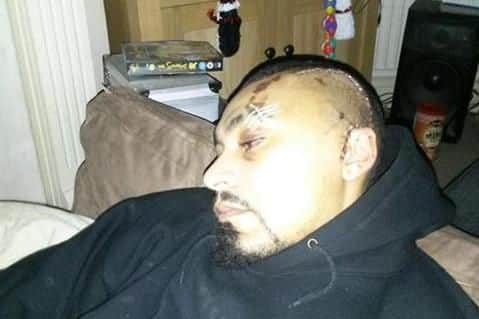 Christoper Williams after the attack