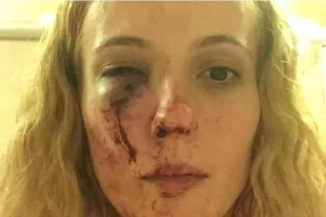 Anca Si Piticii was attacked outside her home