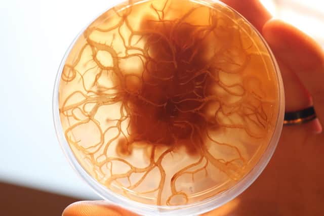 A mushroom culture growth in a petri dish.