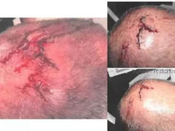 Sgt Richard Pettican's injuries after he was attacked in Doncaster