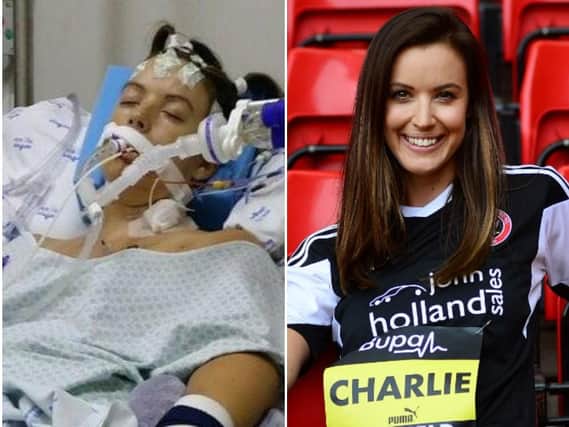 Charlie Webster shared the harrowing photo of herself in a coma. (Photo: Charlie Webster/Twitter).