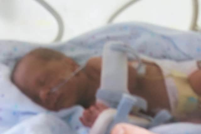 Kai Feast who was treated at Doncaster Royal infirmary after being born prematurely, pictured in his incubator after being born prematurely