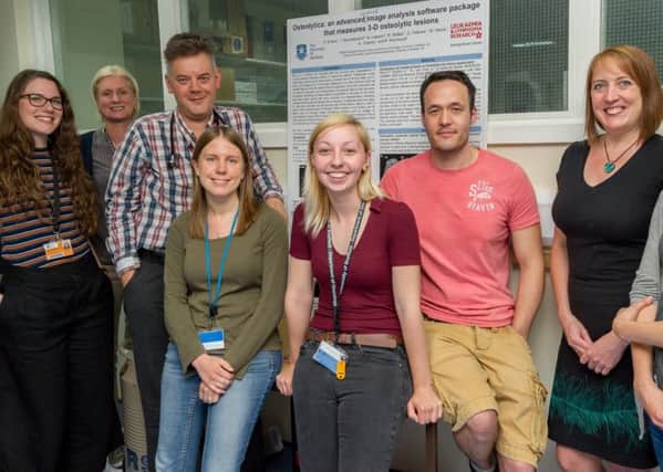 The Sheffield Myeloma Research Team.