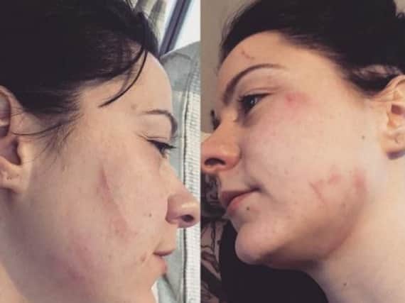 Aftermath of the attack - lspraggan/Instagram
