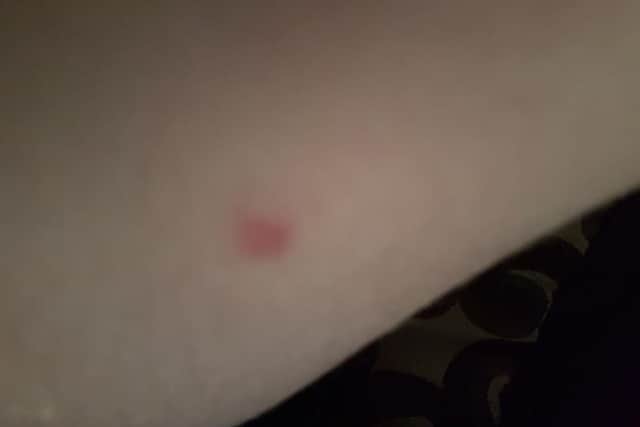 Aaron was injured with a ball bearing