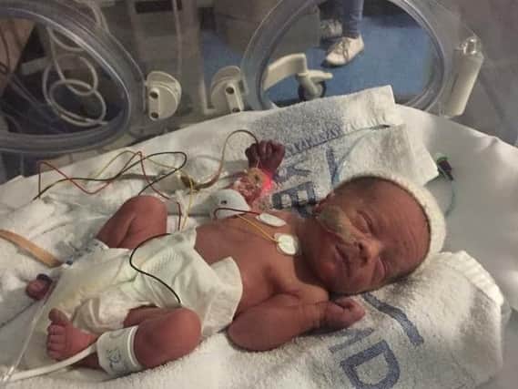 Baby Ollie Kociuba died after being affected by the illness NEC