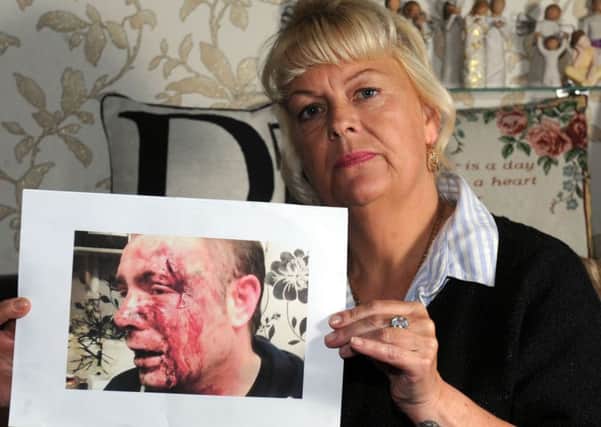 Diane Timms is fighting for justice after an attack on her son in Doncaster in January 2017